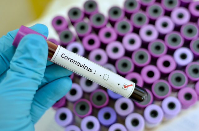 Coronavirus: 18.677 i casi positivi in Emilia-Romagna, 443 in più rispetto a ieri. I casi lievi in isolamento a domicilio sono 8.038. Continuano a salire le guarigioni, e a diminuire i ricoveri